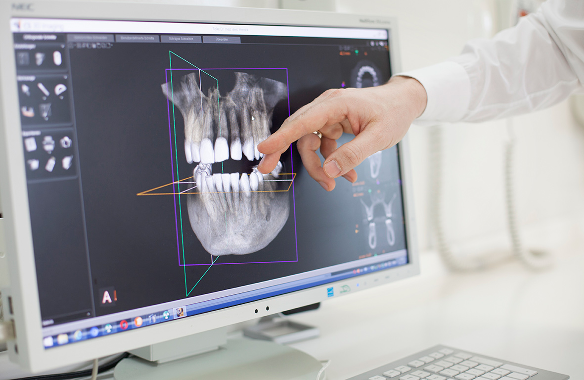 3D Röntgen Hauptstadtzahnärzte